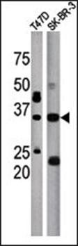 ICMT antibody