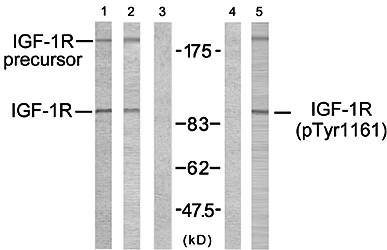 IGFR(Phospho-Tyr1161) Antibody