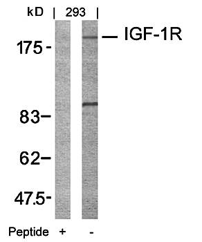 IGFR (Ab161) Antibody