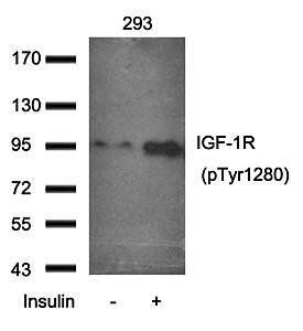 IGFR (Phospho-Tyr1280) Antibody