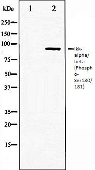 Ikk-alpha/ beta (Phospho-Ser180/181) antibody