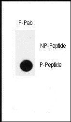 IPF (phospho-Thr11) antibody