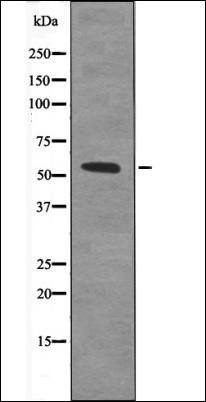 IRF5 (Phospho-Ser437) antibody