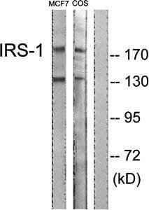 IRS-1 (phospho-Ser1101) antibody