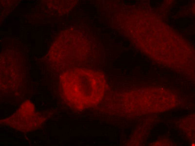 IRS1 (Ab-639) antibody