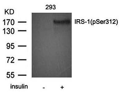 IRS(Phospho-Ser312) Antibody