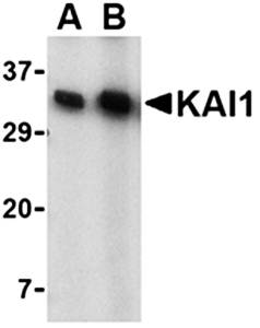 KAI1 Antibody