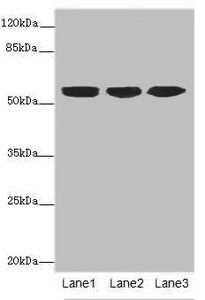 Keratin, type I cytoskeletal 10 antibody