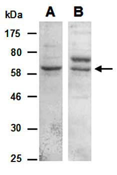 KLRG1 antibody pair