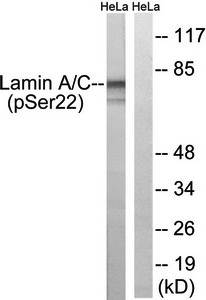 Lamin A (phospho-Ser22) antibody