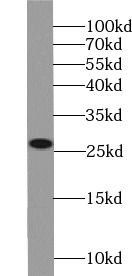 Lin28B-specific antibody