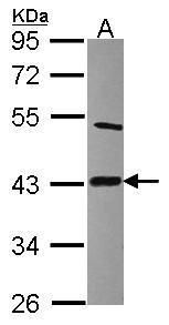 Lipoic acid synthetase antibody