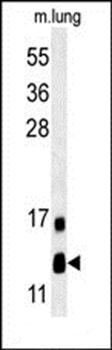 LYRM2 antibody