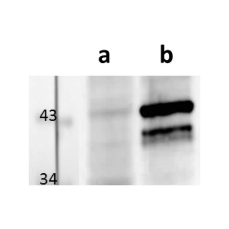 M112-113/E1 (MCMV) antibody