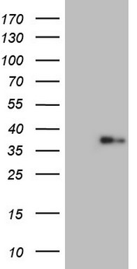 Macrophage Scavenger Receptor I (MSR1) antibody