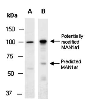 MAN1a1 antibody pair
