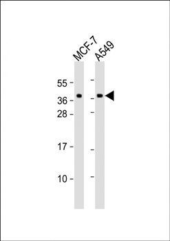 Mast Cell Chymase antibody