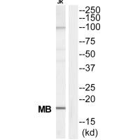 MB antibody