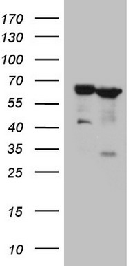 MDA5 (IFIH1) antibody