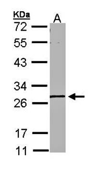 MGC40579 antibody