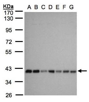 mitochondrial carrier protein MGC4399 antibody