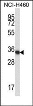 Mouse Hoxa11 antibody