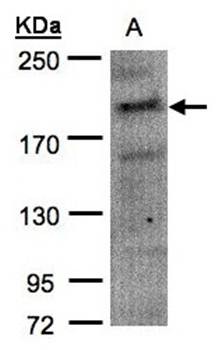 MRCKalpha antibody