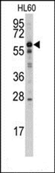 MTM1 antibody