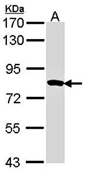 Myotubularin related protein 2 antibody