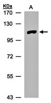myotubularin related protein 4 antibody