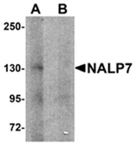 NALP7 Antibody