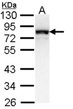 NDUFS1 antibody