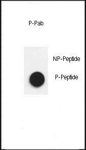 Nephrin (phospho-Tyr1193) antibody