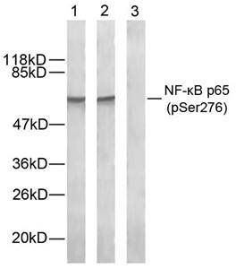 NFκB-p65 (Phospho-Ser276) Antibody