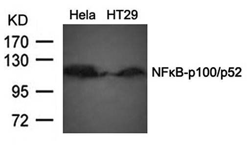 NFκB-p100/p52 (Ab-866) Antibody