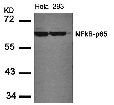 NFκB-p65 (Ab-536) Antibody