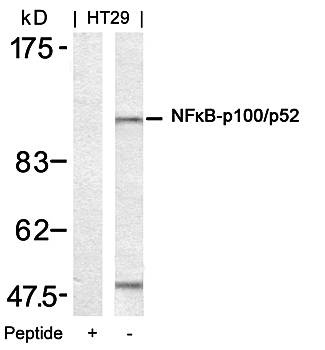 NFκB-p100/p52 (Ab-872) Antibody