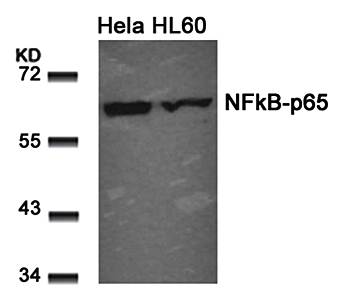 NFκB-p65 (Ab-311) Antibody