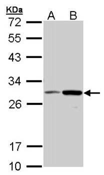 NQO1 antibody
