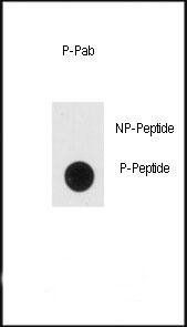 NSE (phospho-Tyr236) antibody