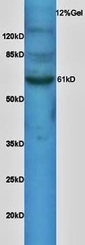 SNX1 antibody