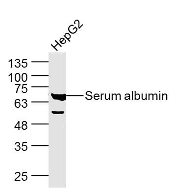 Albumin antibody