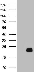 Centrin 3 (CETN3) antibody