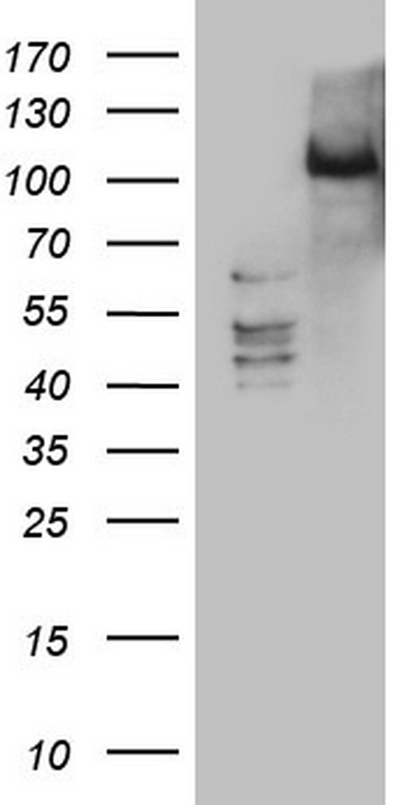 PKC nu (PRKD3) antibody