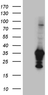 Galectin 3 (LGALS3) antibody