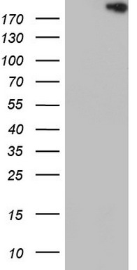 Topoisomerase II alpha (TOP2A) antibody