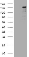 Smad Interacting Protein 1 (ZEB2) antibody
