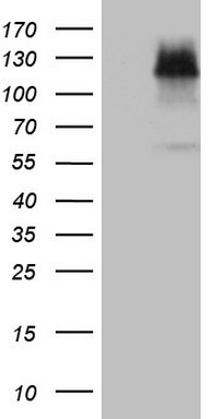 HIF 2 alpha (EPAS1) antibody