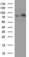Hydroxysteroid (17 beta) Dehydrogenase 4 (HSD17B4) antibody