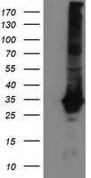 Glutathione S Transferase theta 2 (GSTT2) antibody